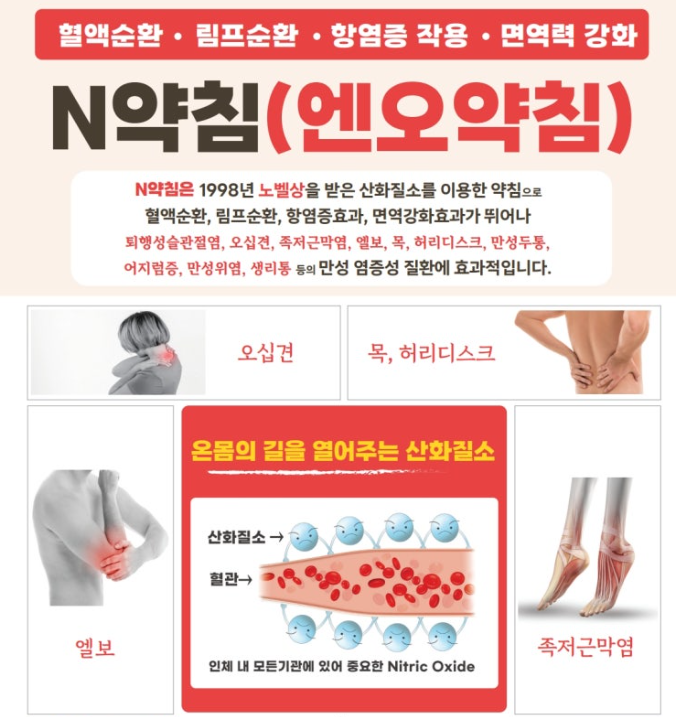 엔오약침 — 산화질소와 혈관 작용 개념도